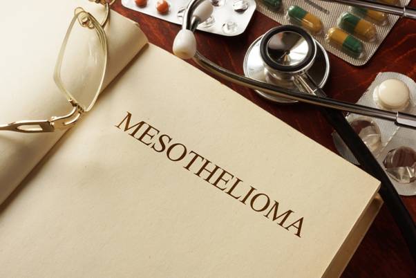 When Should You Hire a Mesothelioma Lawyer?